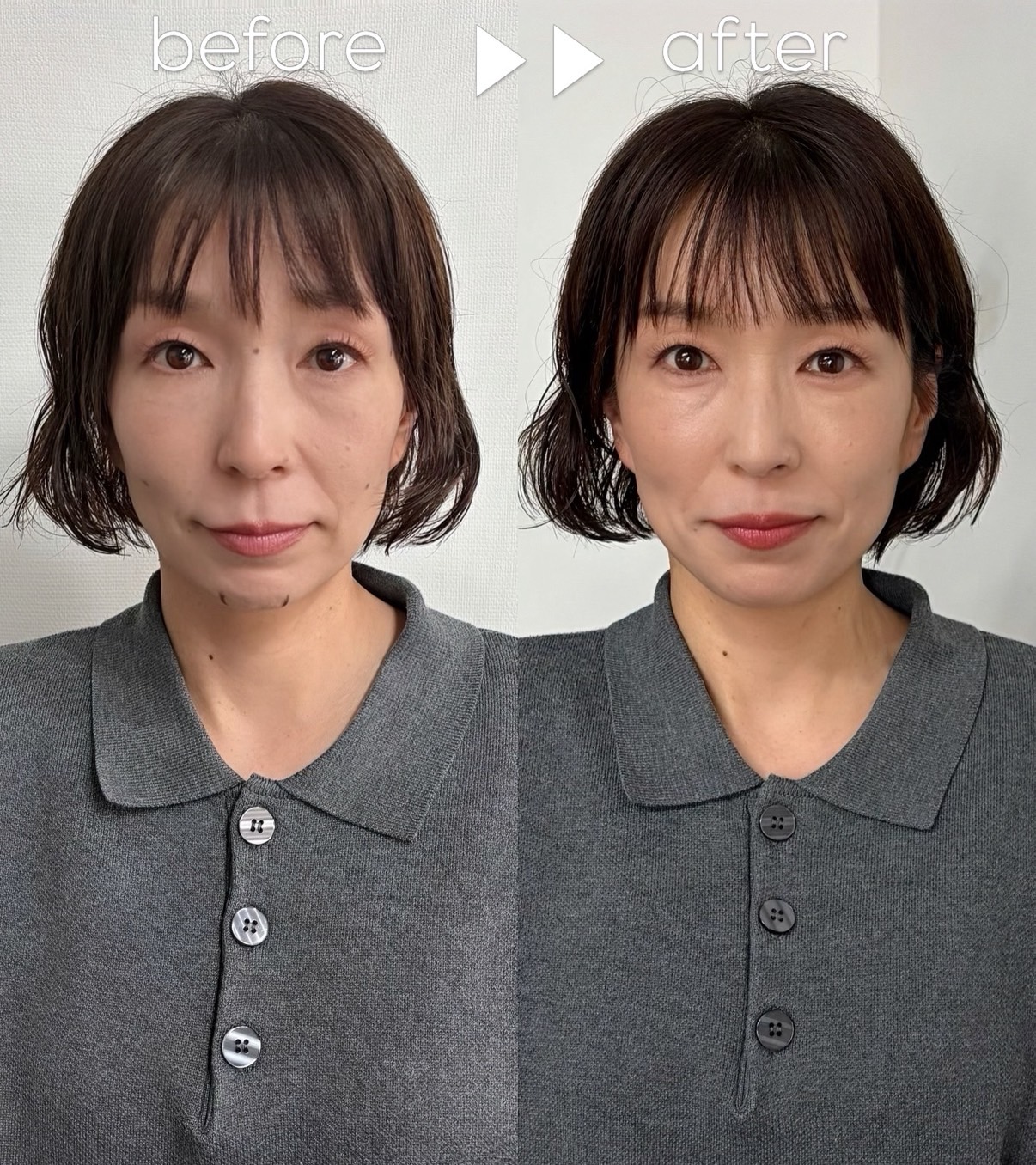 Before & After 01
