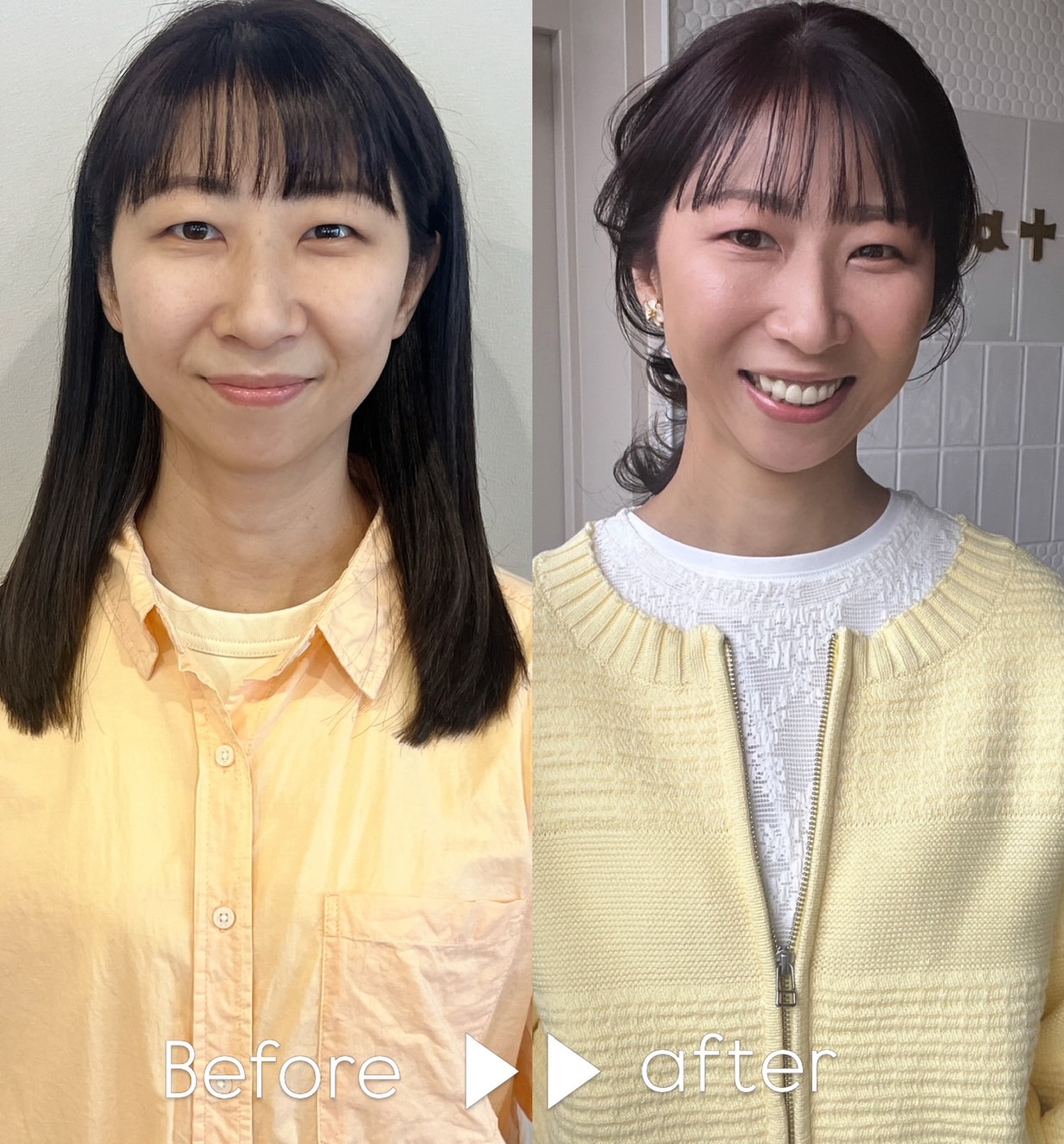 Before & After 02