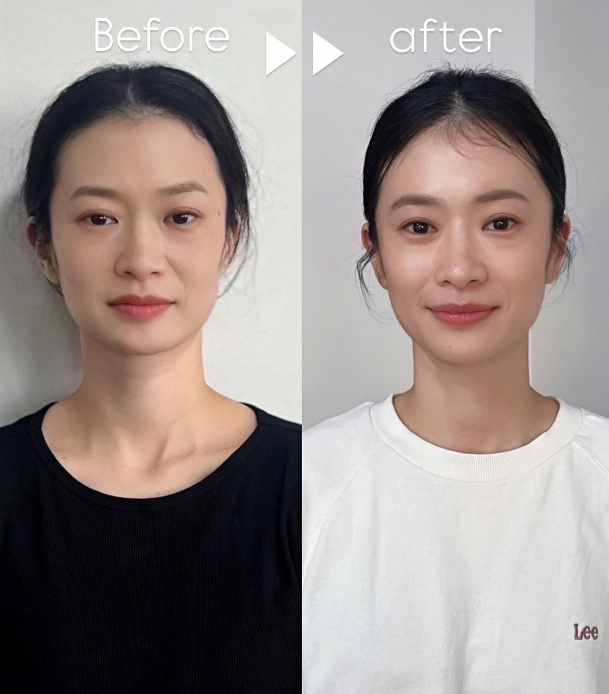 Before & After 05